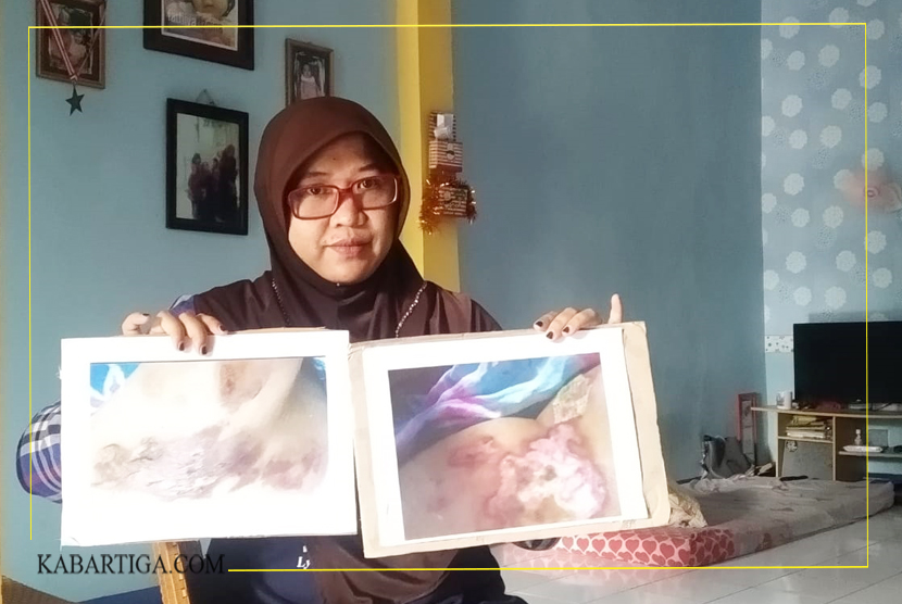 Seorang Pegawai Transjakarta Laporkan Dugaan Malpraktek RS Anna Bekasi ke Menkes