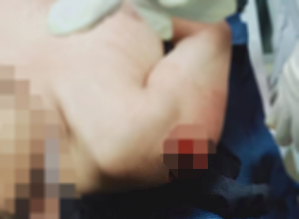 Akibat Ditegur, Kakak Tewas Ditangan Pacar